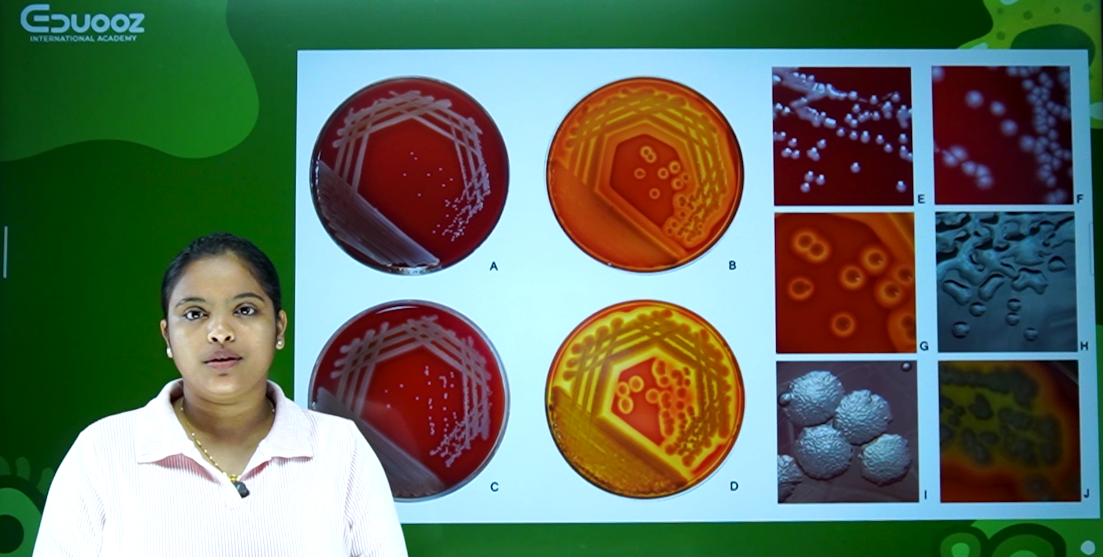 Lecture slide showing microbiology culture plate methods